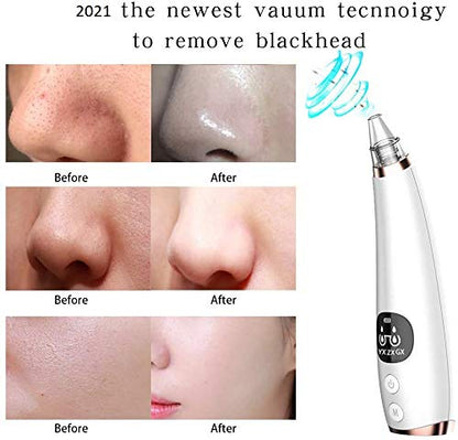 Blackhead Remover vacuum cleaner